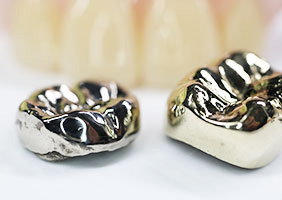 金歯や銀歯、体内に蓄積された金属